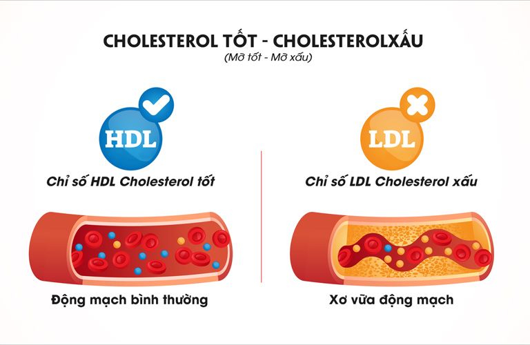 Cholesterol được chia thành 2 loại chính là “tốt” và “xấu”