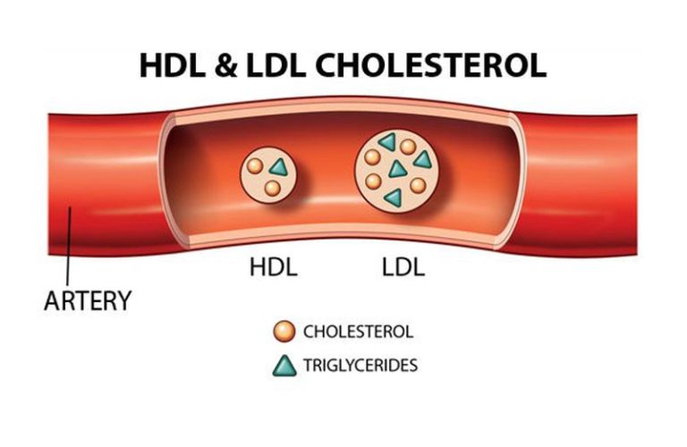 dinh-luong-hdl-cholesterol-thap