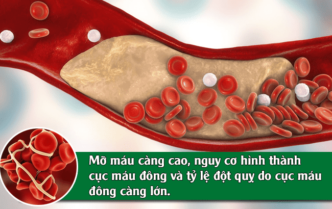 Mỡ máu tăng cao làm tăng nguy cơ đột quỵ