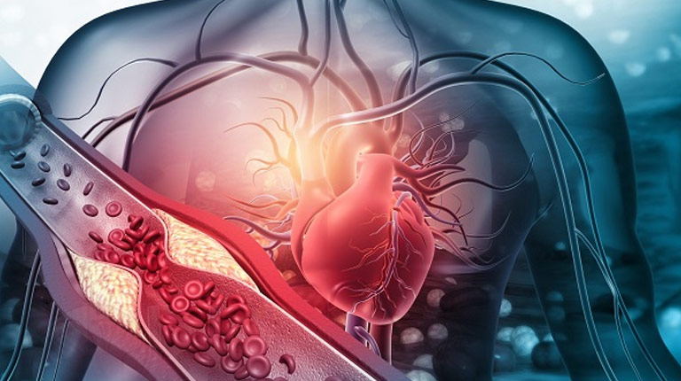 Lá sen chứa saponin giúp tăng đào thải Cholesterol