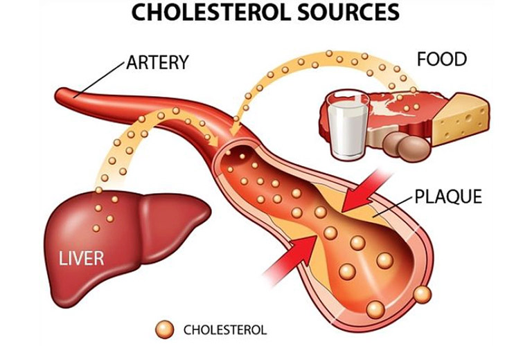 Cholesterol là một chất béo dạng sáp, không tan trong nước, được sản xuất chủ yếu ở gan