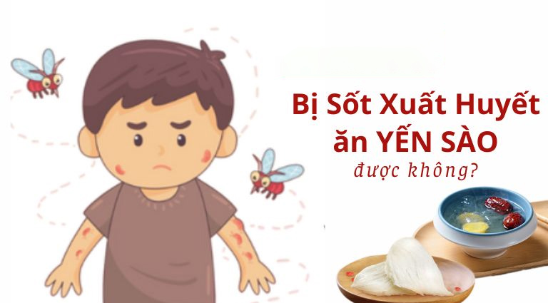 Bị Sốt Xuất Huyết Có Ăn Yến Được Không? Khám Phá Lợi Ích và Khuyến Cáo