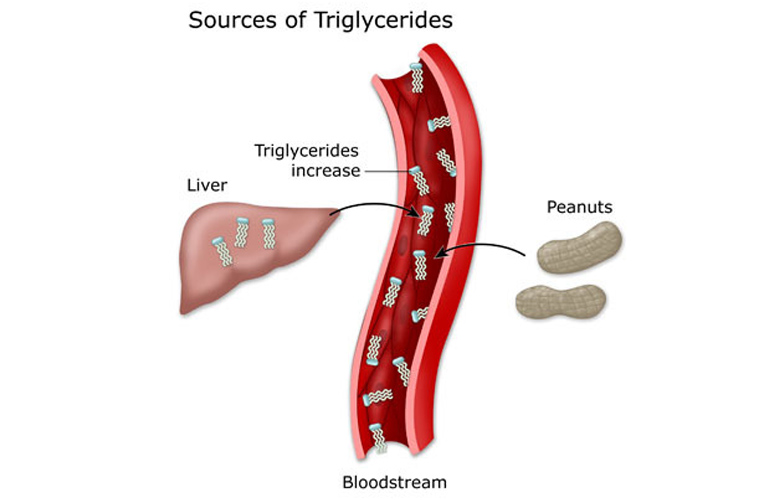 Triglyceride là một loại chất béo trung tính, được hình thành từ glycerol và ba acid béo