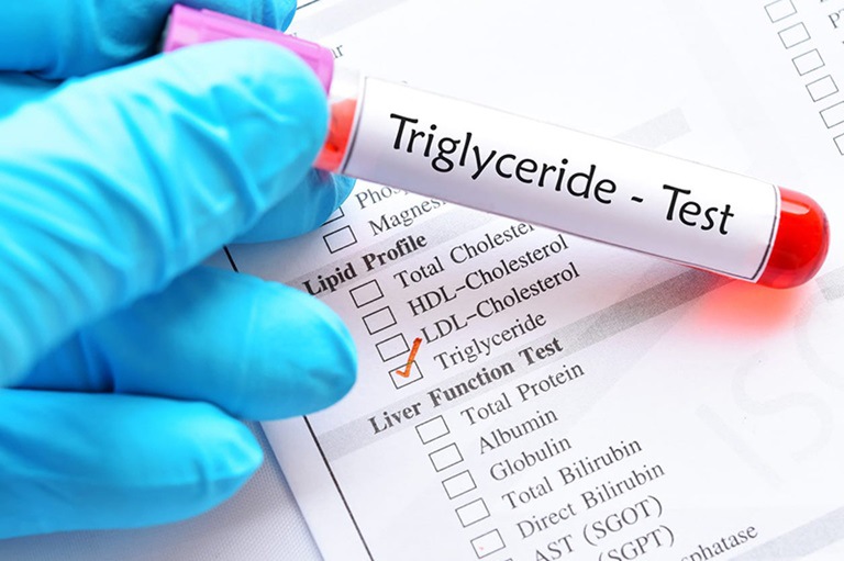 Gan nhiễm mỡ liên quan đến việc tăng nồng độ triglyceride trong máu