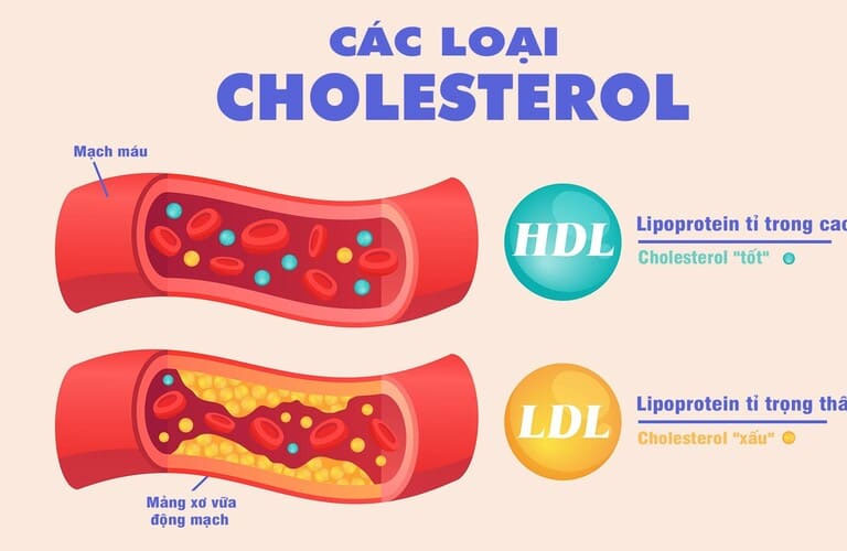 Cholesterol là một loại chất béo có trong mọi tế bào của cơ thể