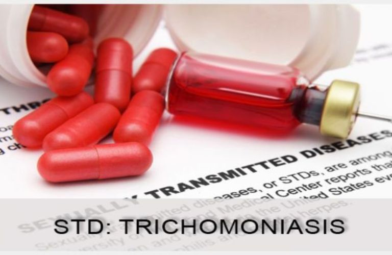 viem-am-dao-do-Trichomonas (3)