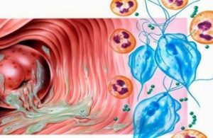 viem-am-dao-do-trichomonas