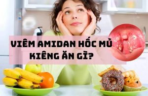 Viêm Amidan Hốc Mủ Kiêng Ăn Gì Để Tránh Bệnh Nặng Thêm?