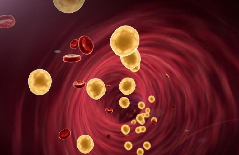 roi-loan-lipid (2)