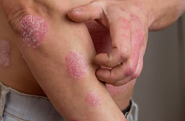 Các triệu chứng kéo dài hơn 2 tuần cần thăm khám bác sĩ