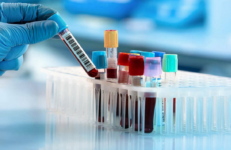 Xét nghiệm máu có khả năng phát hiện chàm dị ứng