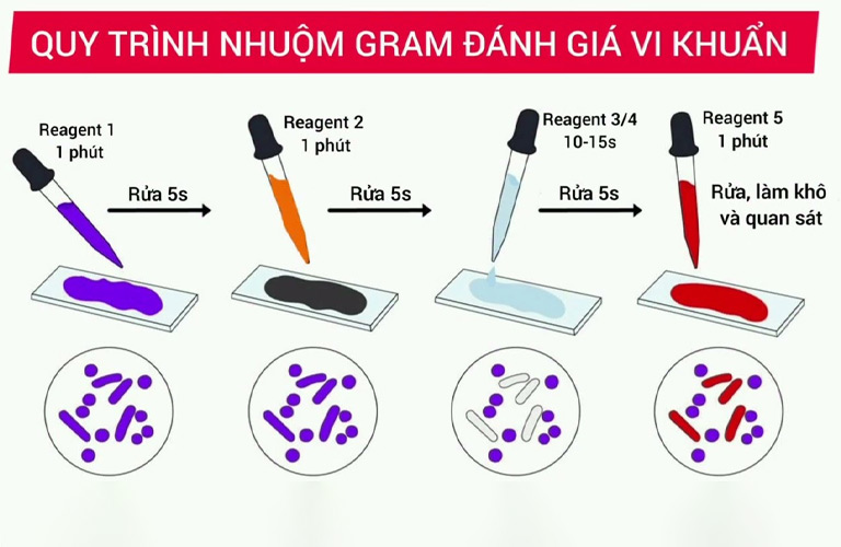 Nhuộm Gram được chỉ định để xác định vi khuẩn